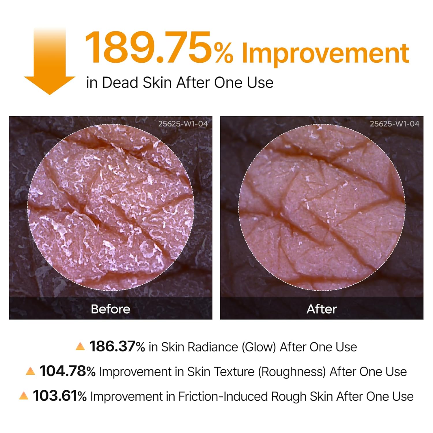 Peel Shot Kojic Acid Turmeric Body Exfoliator Spray 6.76 Fl.Oz